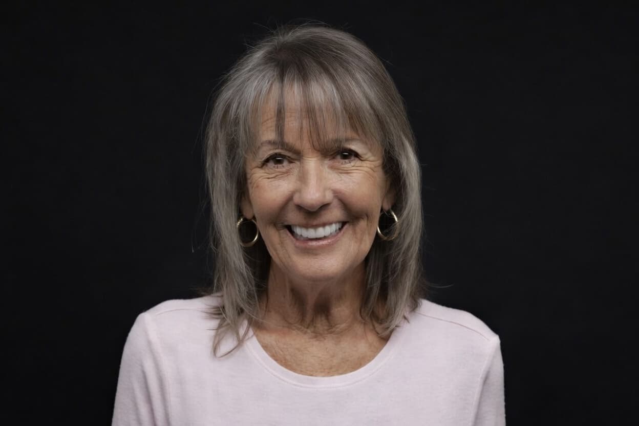 Full-mouth dental implant patient after treatment