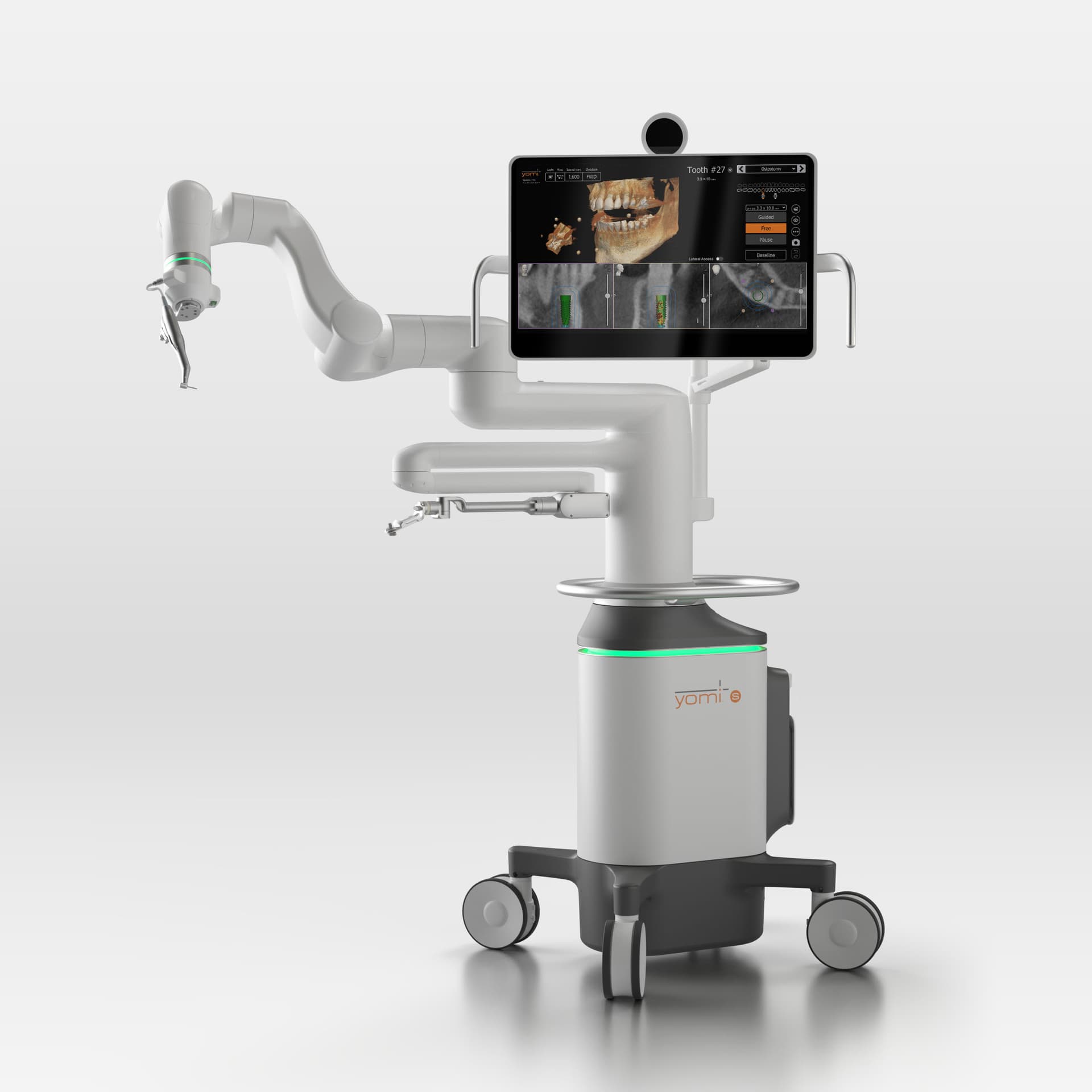 Yomi robotically assisted dental implant surgery system